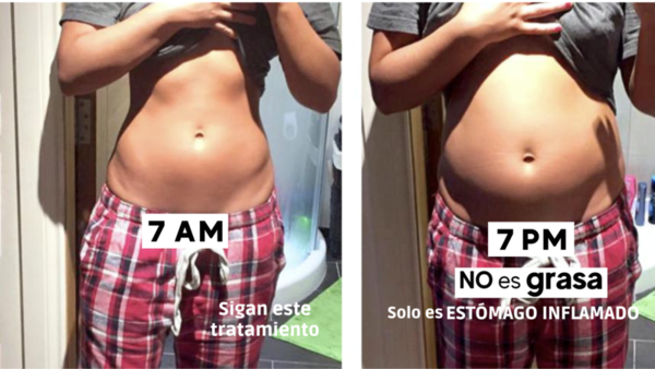 Imagen de una personacon el estomago inflamado