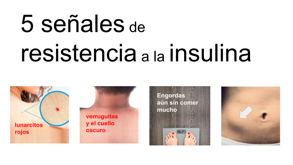 5 Se ales De Resistencia A La Insulina